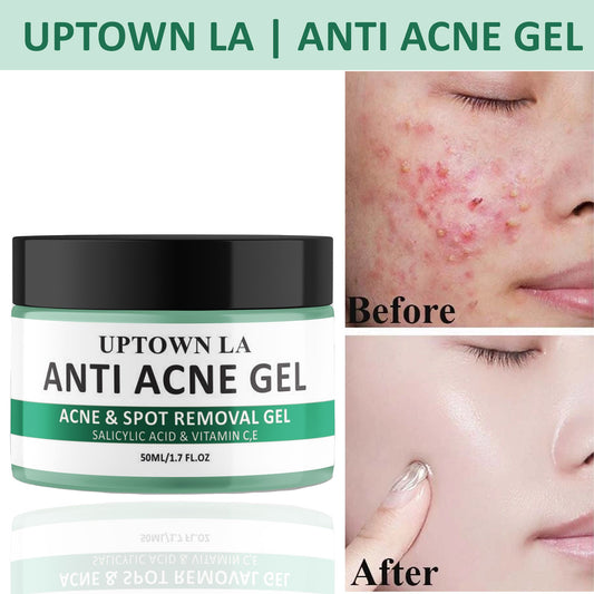 UPTOWN LA Anti Acne Gel for Acne Prone Skin and Acne Scars Marks with Niacinamide and Salicylic Acid | Anti Acne Face Treatment for Dark Spots | 50 ml