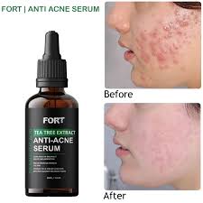 FORT 2% Salicylic Acid & Tea Tree Extract Acne Serum - 30ml