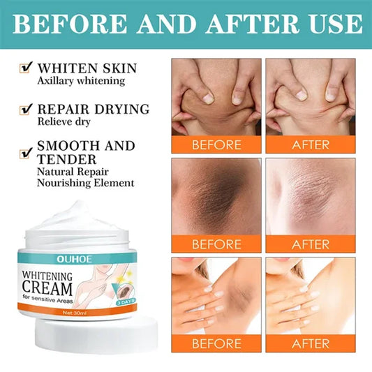 whitening cream for Private part and sensitive areas underarm 7 days result cream.